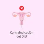 Requisitos para el Implante Anticonceptivo en el Brazo: Una Guía Completa
