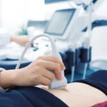 Requisitos para Realizarse un Ultrasonido Pélvico: Una Guía Completa